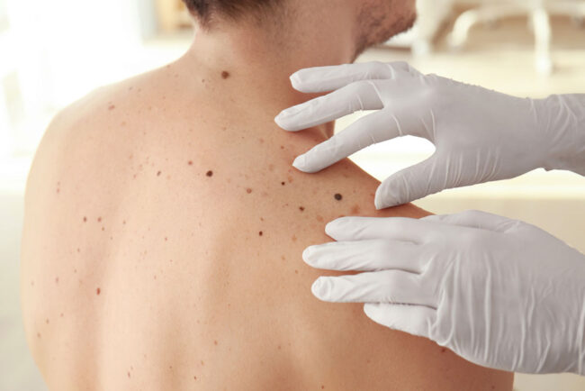 skin-examination skin-examination