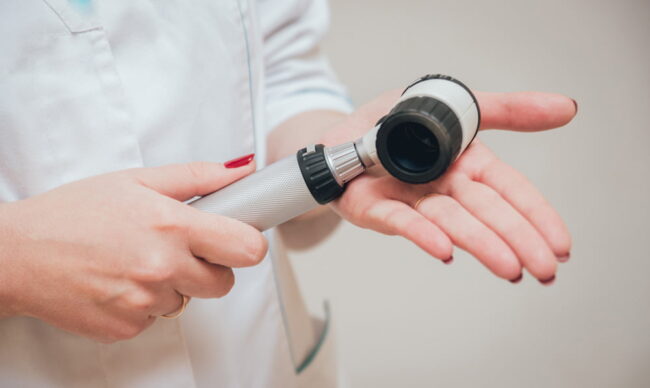 dermatoscopy dermatoscopy