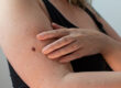 skin-arm